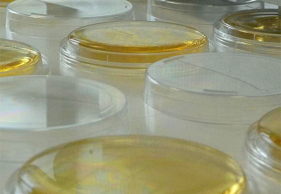 為什么說在層流環(huán)境無人的情況下不必絕對要做微生物含量檢查.jpg 為什么說在層流環(huán)境無人的情況下不必絕對要做微生物含量檢查.jpg